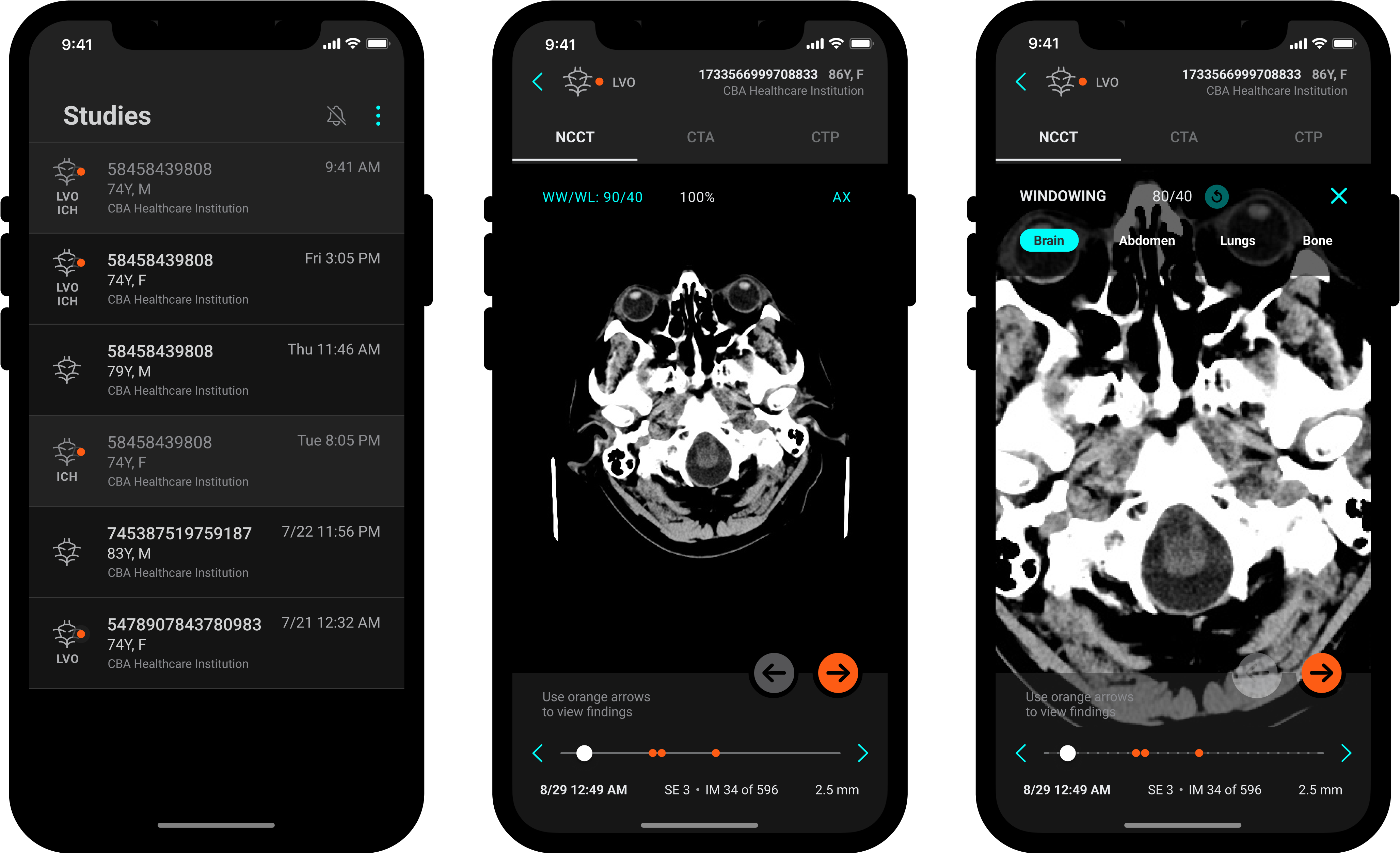 **Mobile app** • List view; Scan view; Zoom in